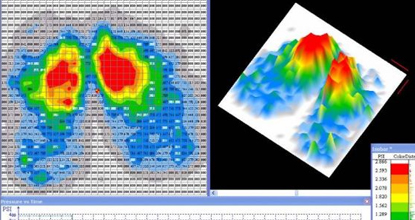 Pressure Mapping Technology